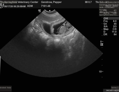 Ultrasound